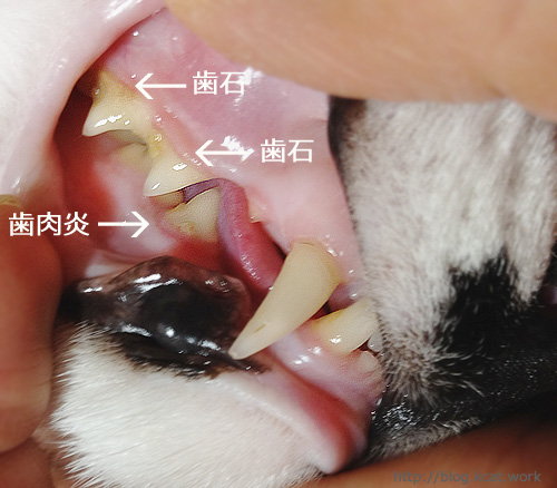 クロの歯と歯ぐきの状態