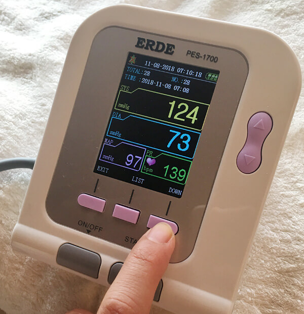 ペット用血圧計ERDE（エルデの）メモリーボタンを押すと…